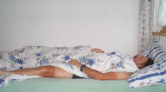 Carlo das Zebra, typische Radfahrerbräune ;-)