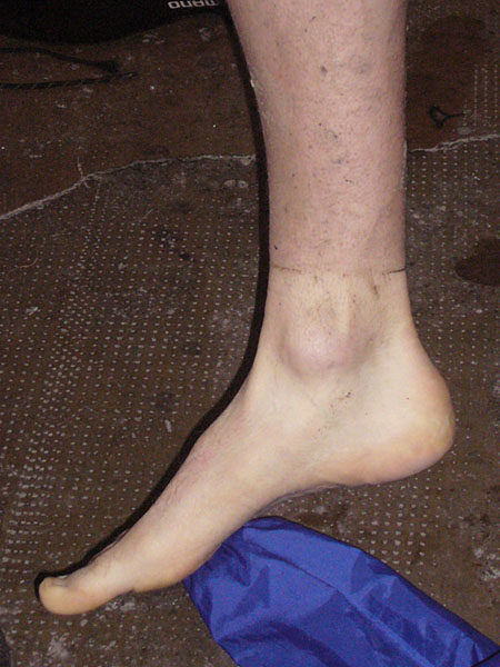 Der untere Teil ist das saubere St&uuml;ck ;-)